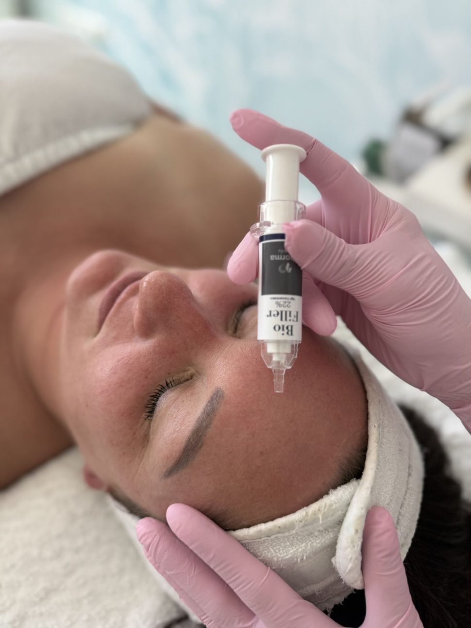 Aplikácia produktu počas ošetrenia Biofiller Hydrovolume v MS Studio
