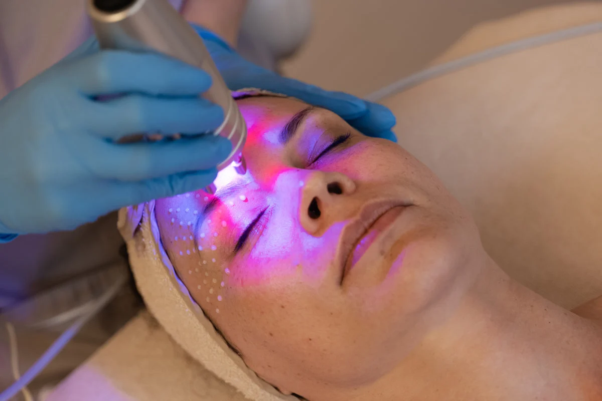 Ošetrenie pleti technológiou PhormaLaser Therapy